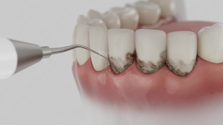 Trusted Dental Crowns And Bridges service in Amherst, TX - Dentist Open Now